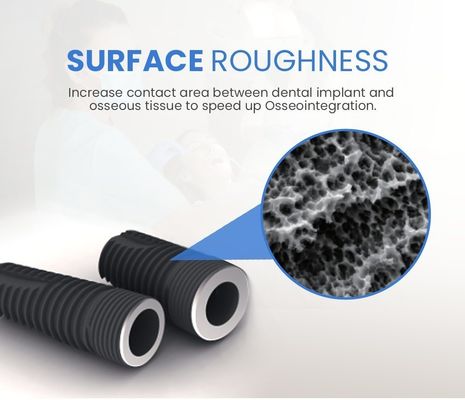 Implantation dentaire personnalisée 2D/3D Abutment prothétique pour les implants de cou réguliers étroits