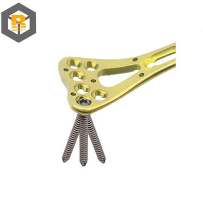 Partie d'usinage de précision CNC à l'aide d'une plaque de verrouillage à broche à rayon distale multi-axial