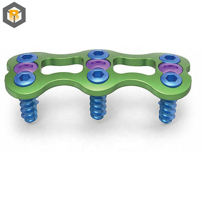 Personnalisé par 2D/3D/Drawing Instruments Screw corticale d'implant orthopédique